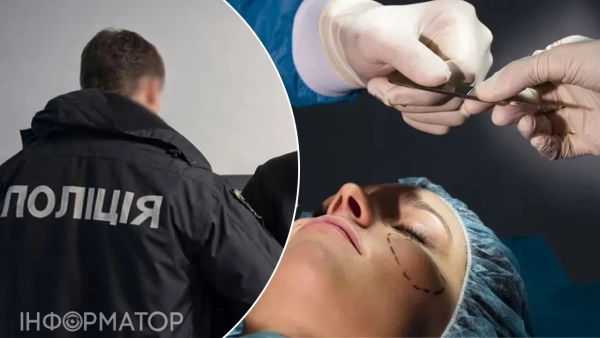 Поліція, пластична операція
