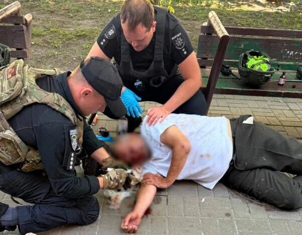 Перехожий у Києві втратив свідомість на вулиці через 30-градусну спеку.
