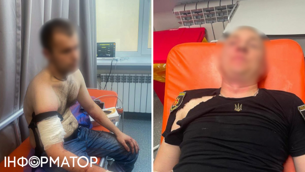 У Запоріжжі чоловік, що проходить у кримінальній справі, напав на правоохоронців під…